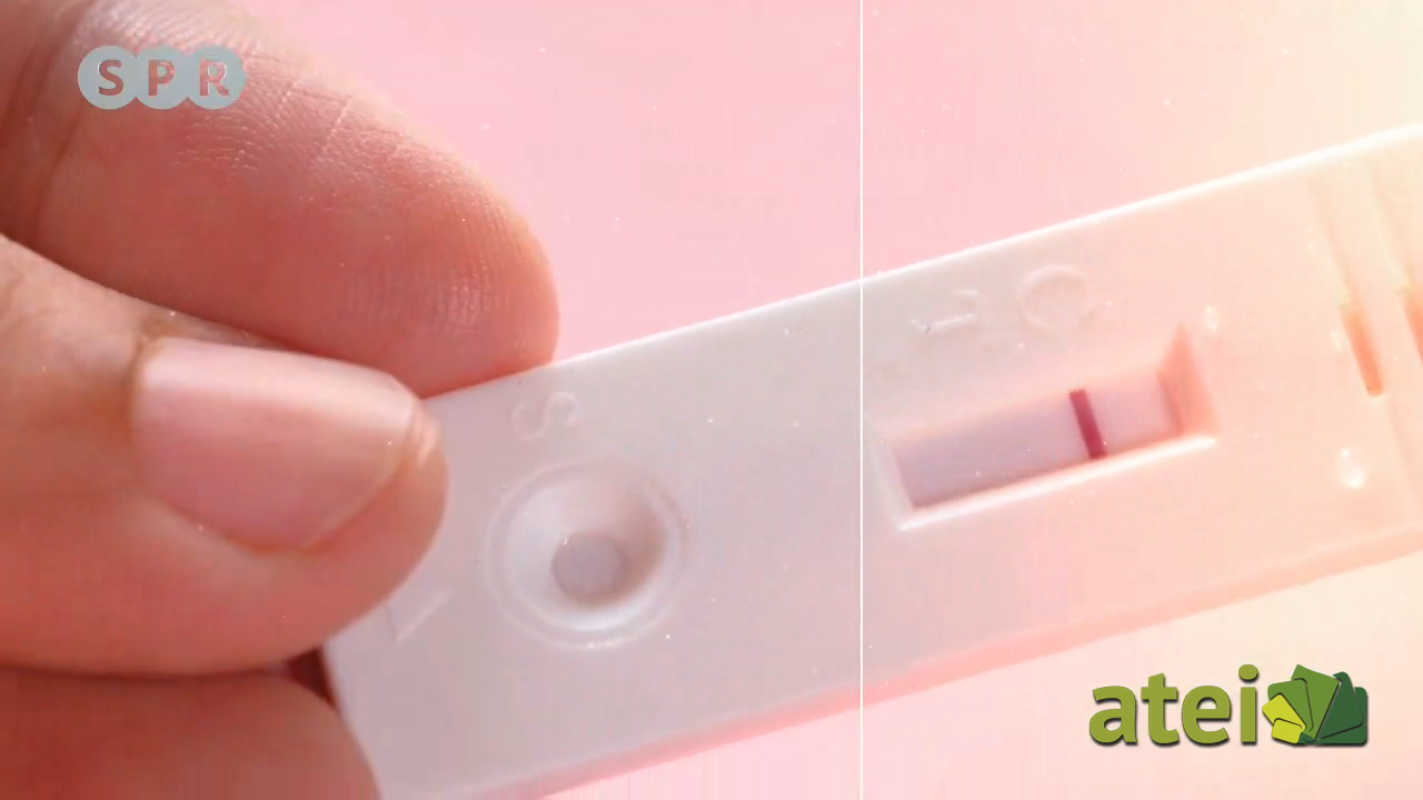 Embarazo adolescente. ¿Origen es destinó B2